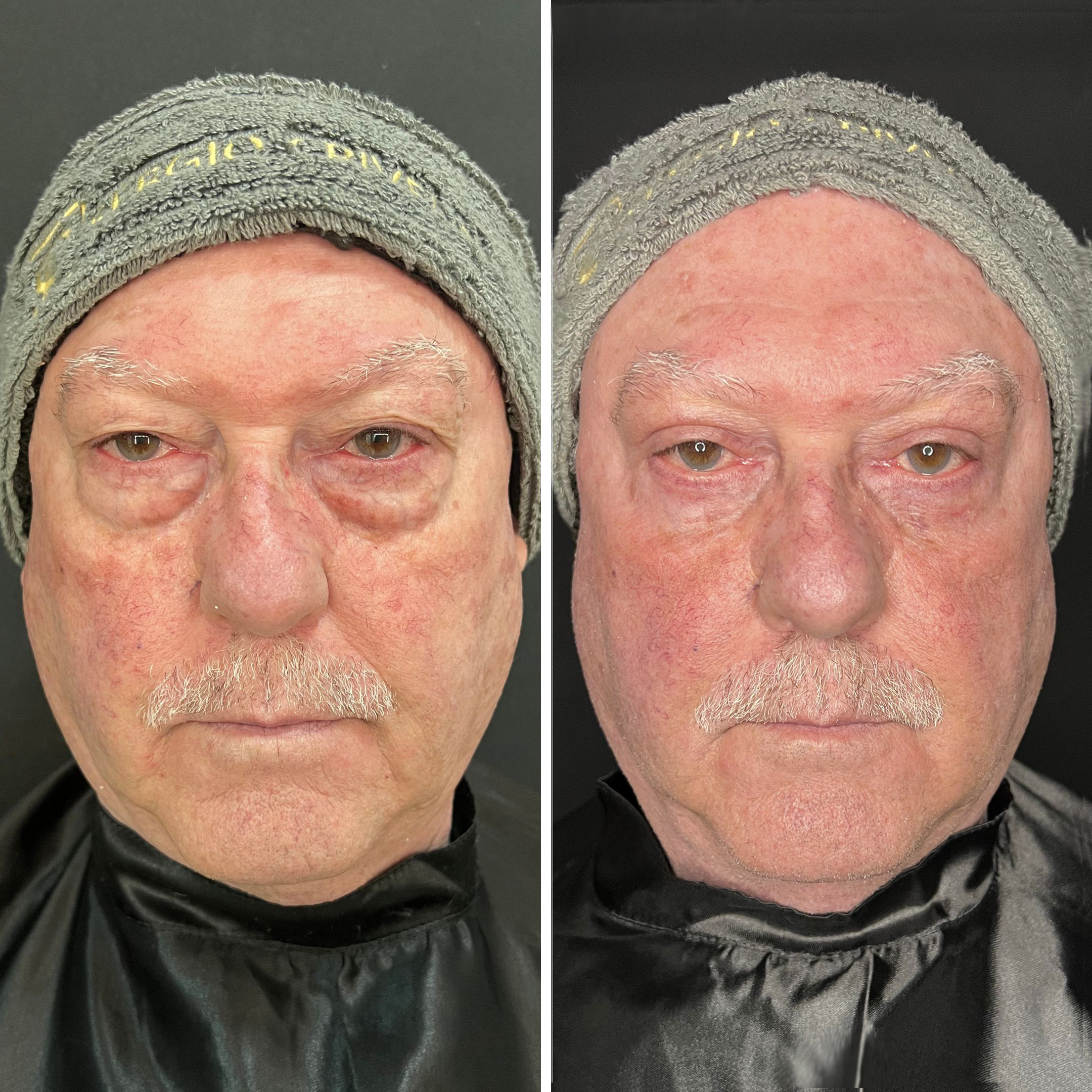 Pedro Tadeu Vicentini - 1